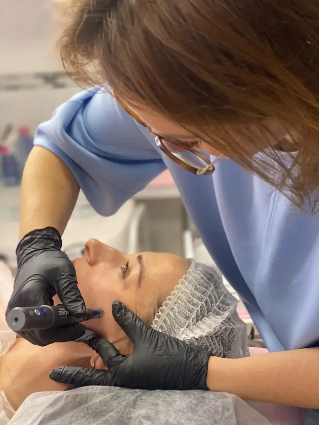 Mezoterapia mikroigłowa – zabieg urządzeniem typu pen na skórze twarzy